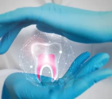 علاج الجذور