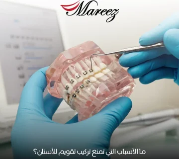 أسباب تمنع تركيب التقويم