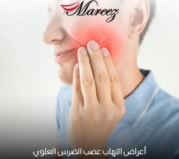أعراض التهاب عصب الضرس العلوي