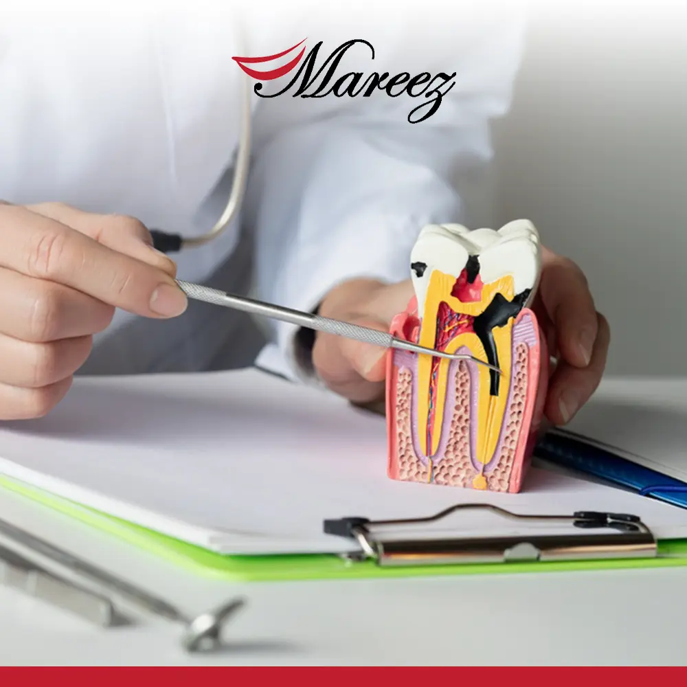 أعراض التهاب عصب الضرس العلوي استشارتك الطبية عبر أطباء عيادة ماريز لطب الأسنان!