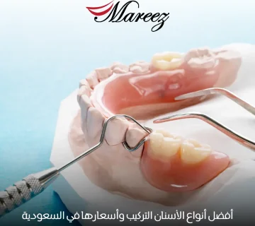 أنواع الأسنان التركيب وأسعارها