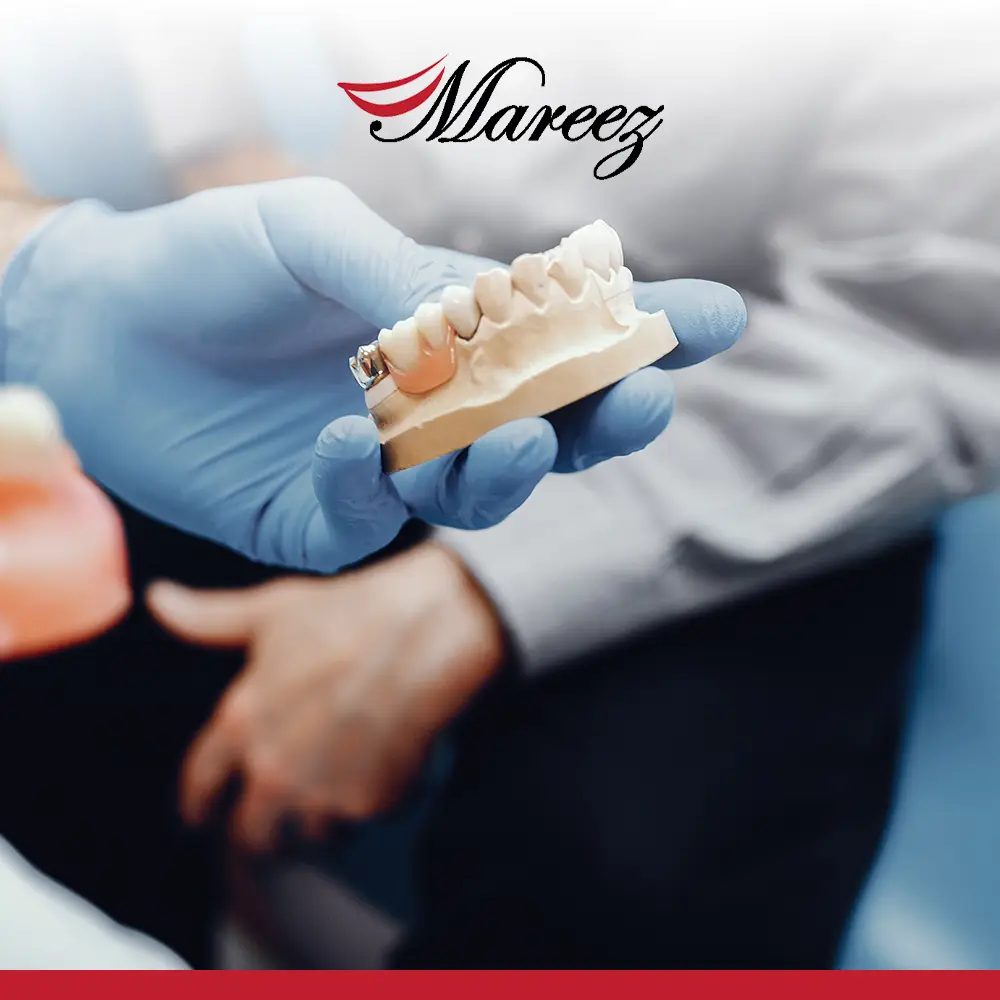 أفضل عيادة زراعة أسنان في جدة كيف تضمن علاجك من أفضل دكتور زراعة أسنان في جدة