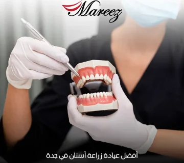 أفضل عيادة زراعة أسنان في جدة