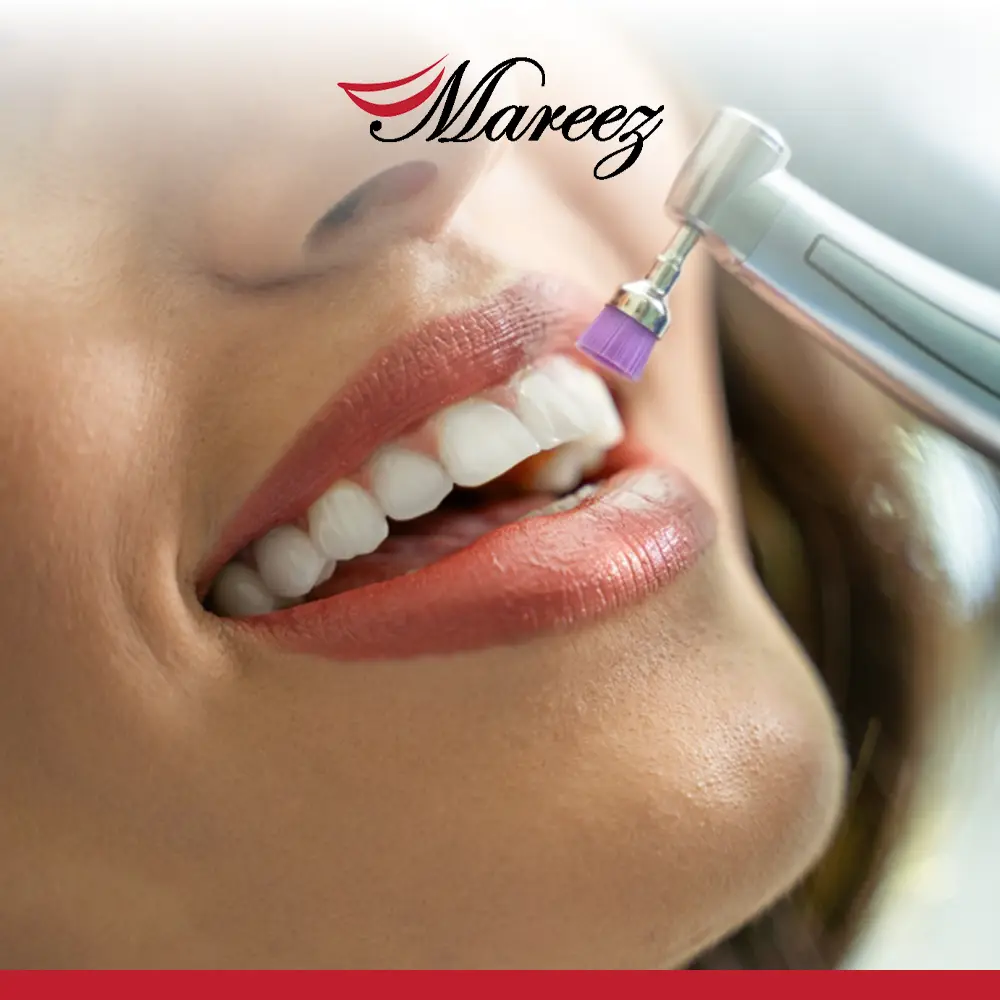 أنواع تبييض الأسنان وأفضلها متى يجب تبييض الأسنان وما هي المدة اللازمة لتجديده؟