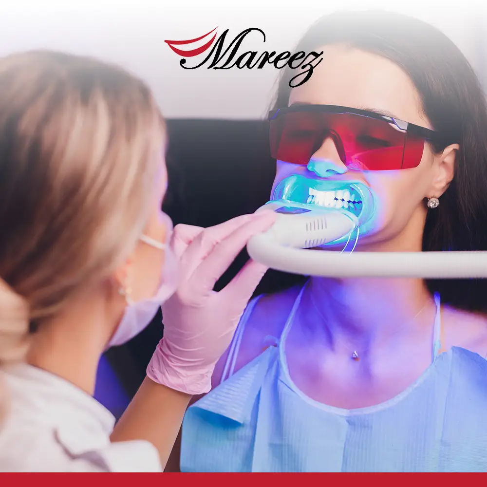 أنواع تبييض الأسنان وأفضلها كيف تحدد أفضل طريقة لتبييض الأسنان طبياً ؟