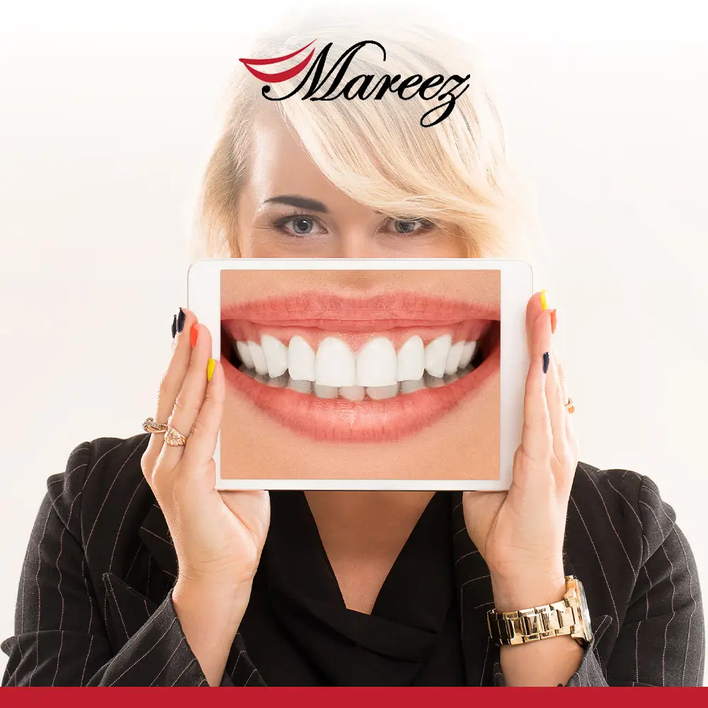 أنواع تبييض الأسنان وأفضلها تعرف على أنواع تبييض الأسنان وأسعارها الشائعة