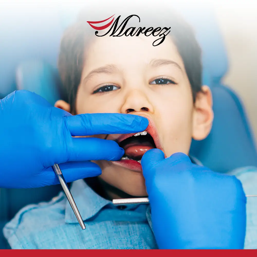 التهاب اللثة عند الأطفال بعمر السنة هل التهاب اللثة عند الأطفال يسبب ارتفاع درجة الحرارة؟