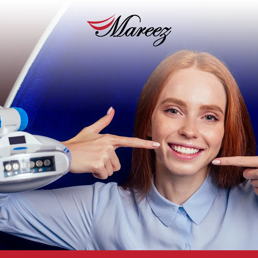 تجميل الأسنان الأمامية بالفينير أفضل طريقة لتجميل الأسنان الأمامية بالفينير