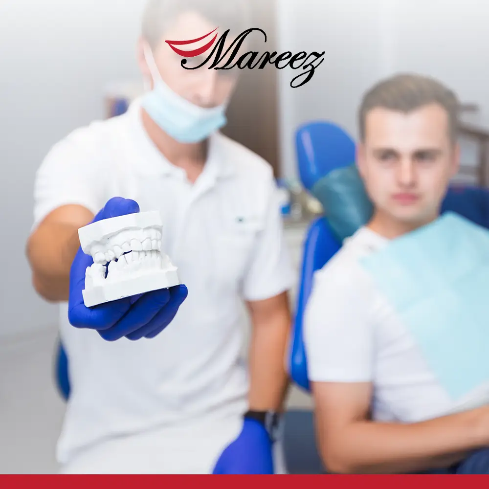 أفضل أنواع جسور الأسنان كم يدوم جسر الأسنان وما هي العوامل المؤثرة عليه؟