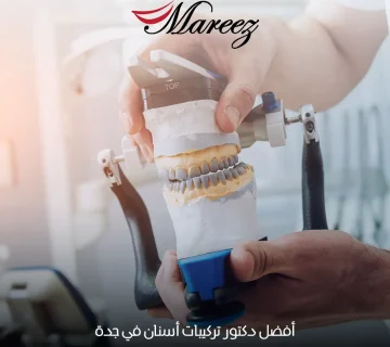 أفضل دكتور تركيبات أسنان في جدة