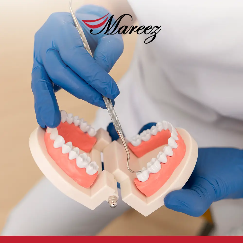 أفضل طريقة لتعويض الأسنان المفقودة ما هي أفضل طريقة لتعويض الأسنان الأمامية؟