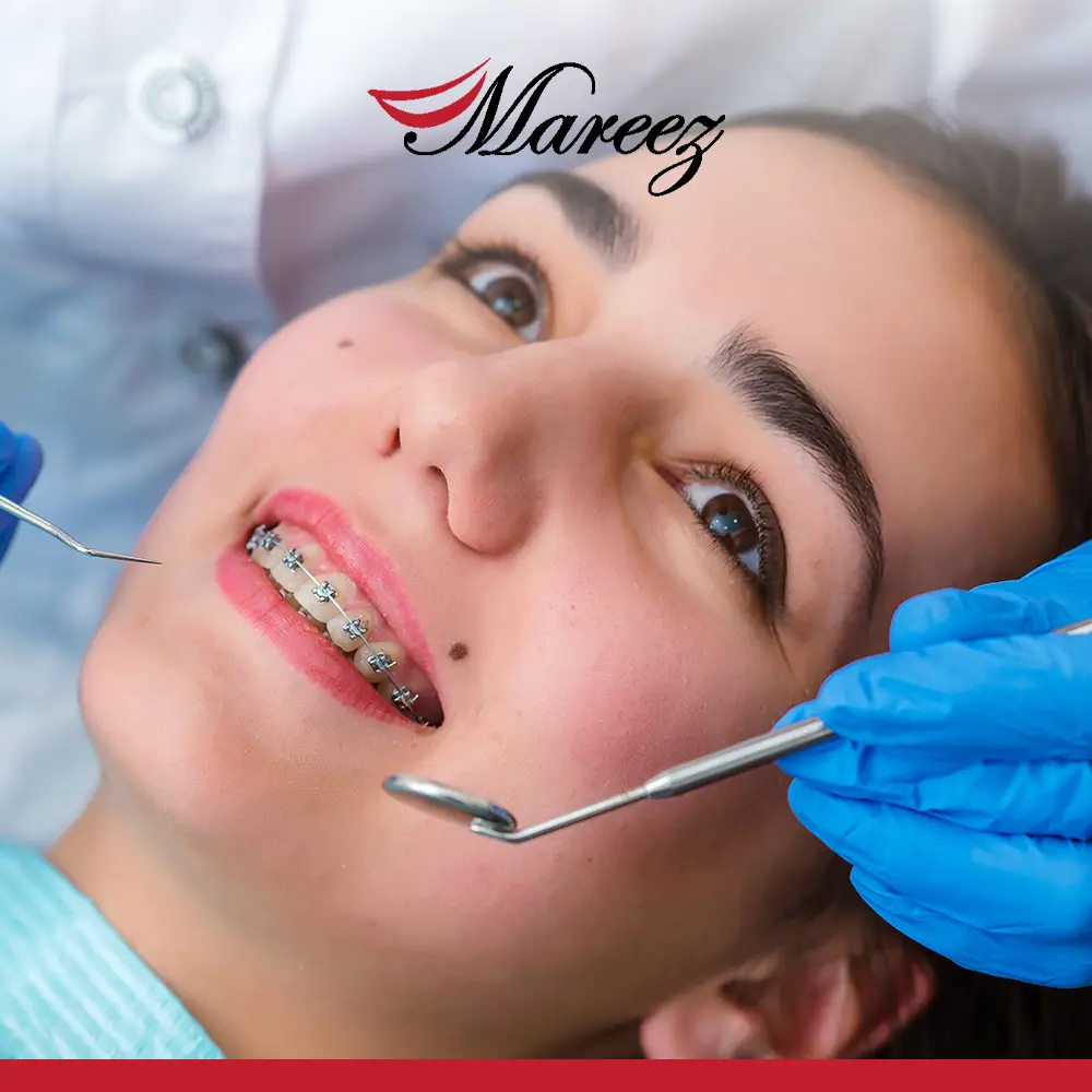 أفضل عيادة أسنان في جدة للتقويم هل تختار عيادات تقويم أسنان بجدة رخيصة أم بجودة عالية؟