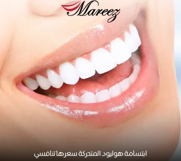 ابتسامة هوليود المتحركة سعرها