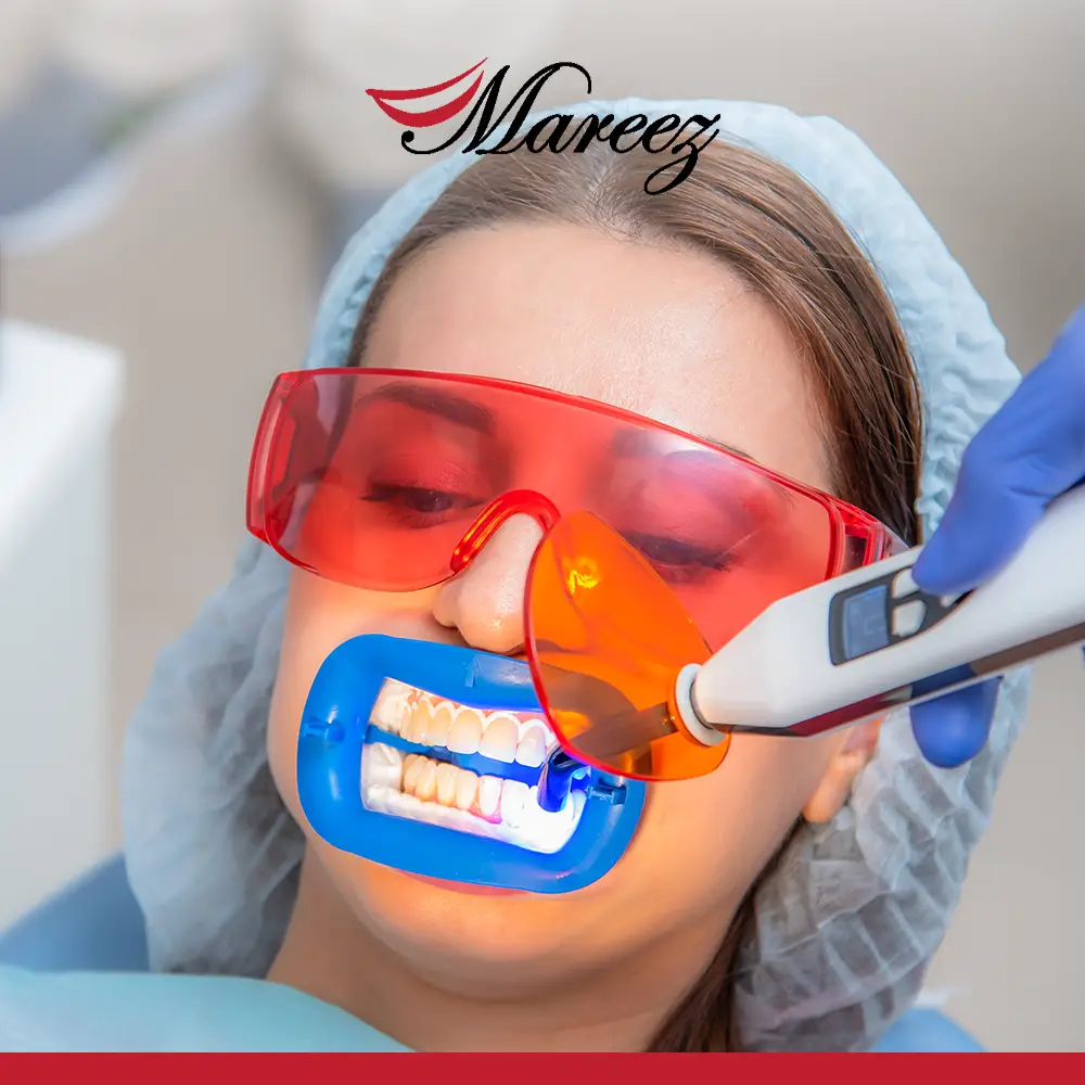 الفرق بين تبييض وتلميع الأسنان ما هو الخيار الأفضل تلميع الأسنان أم تبييضها؟