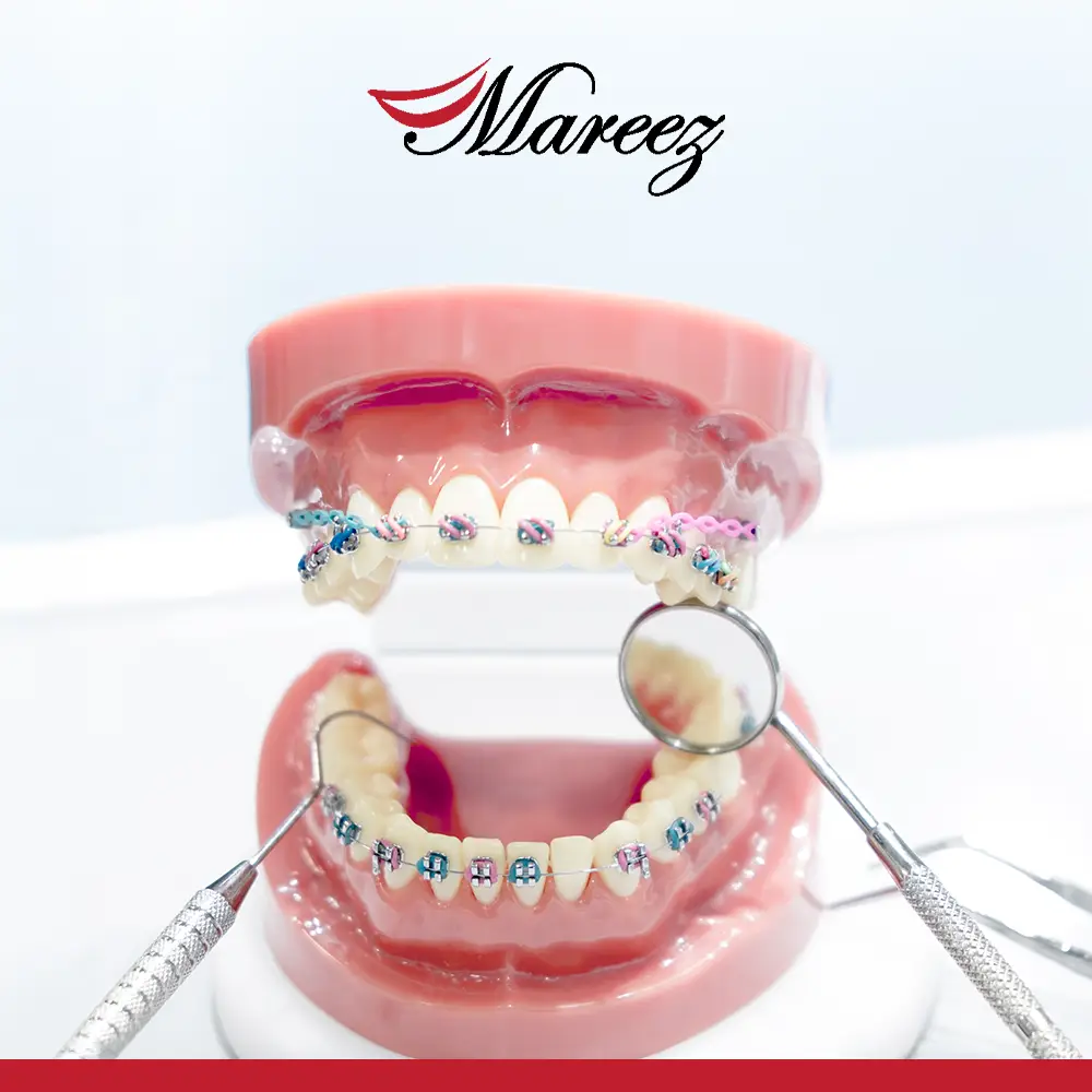 مستوصف تقويم أسنان أين تجد أفضل دكتور تقويم أسنان أطفال في جدة؟