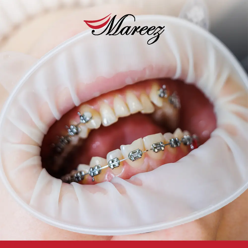 مستوصف تقويم أسنان