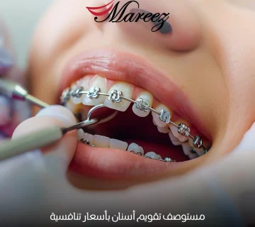مستوصف تقويم أسنان