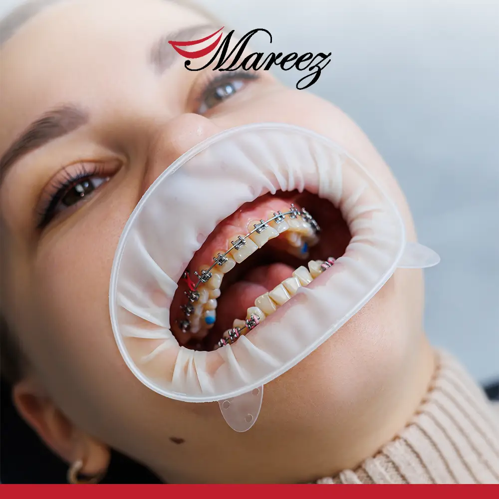 مستوصف تقويم أسنان تعرف على أفضل عيادة تقويم أسنان جدة