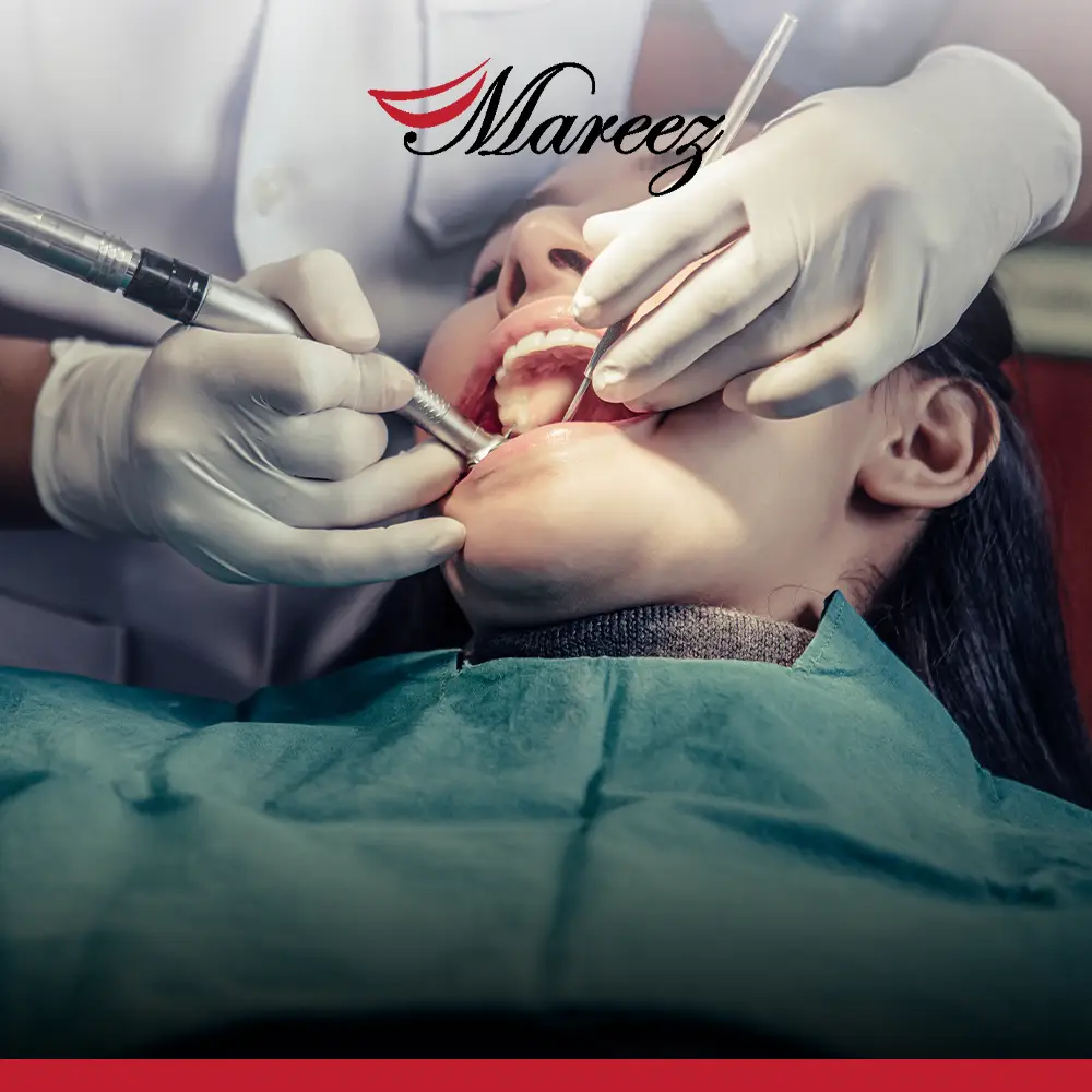 نصائح بعد إزالة ضرس العقل ما هي أنواع الأكل الممنوع بعد خلع ضرس العقل؟