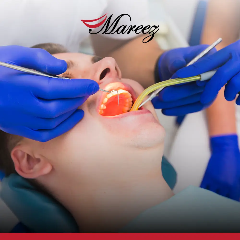 نصائح بعد إزالة ضرس العقل تعرف على أهمية التعليمات بعد خلع ضرس العقل التي تقدمها ماريز؟